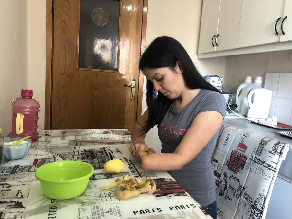 Kolunu Makineye Kaptıran Kadının Tek İsteği Protez El